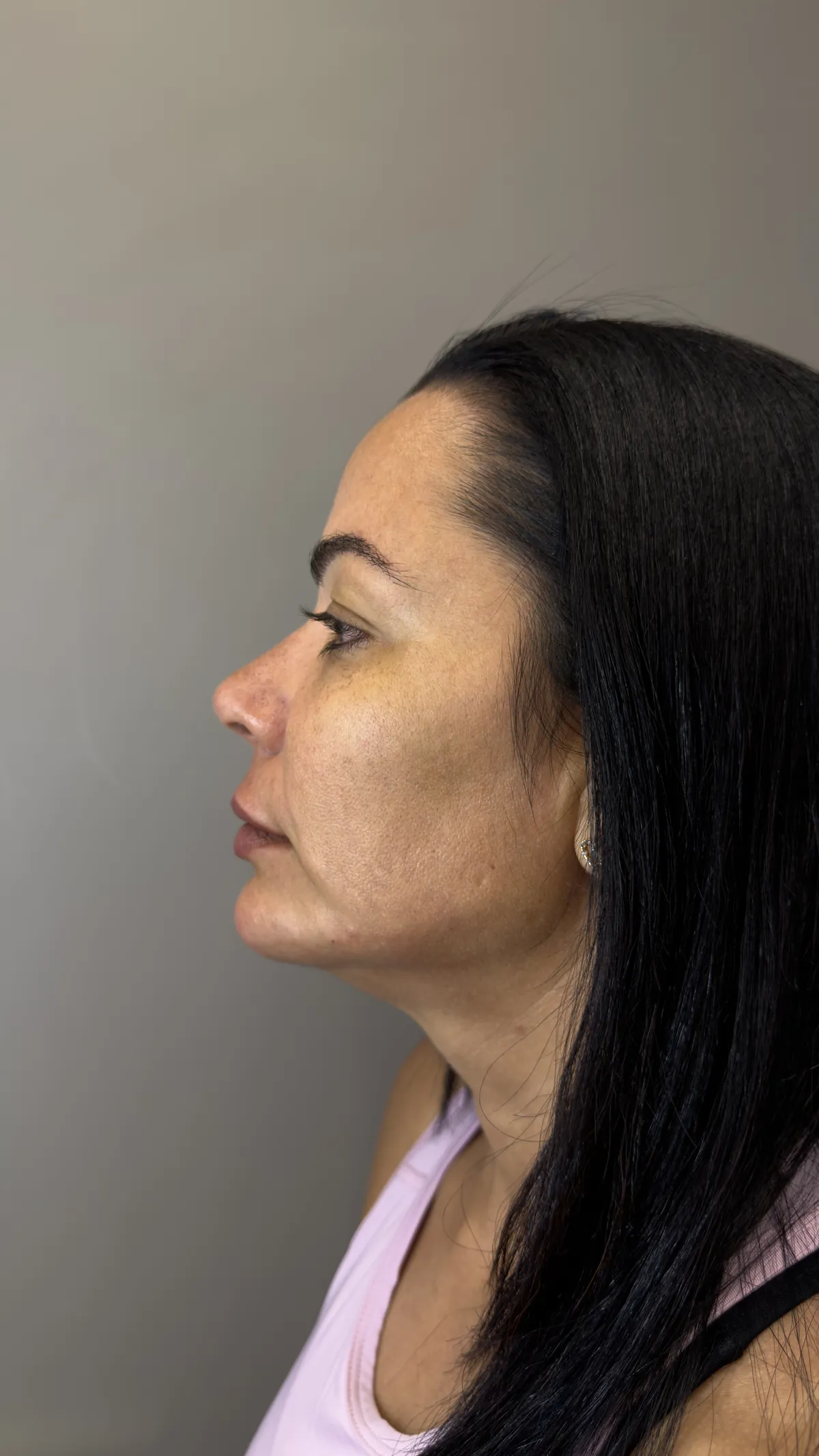 Single Contour